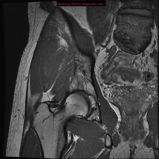 Stanford Msk Mri Atlas 2020