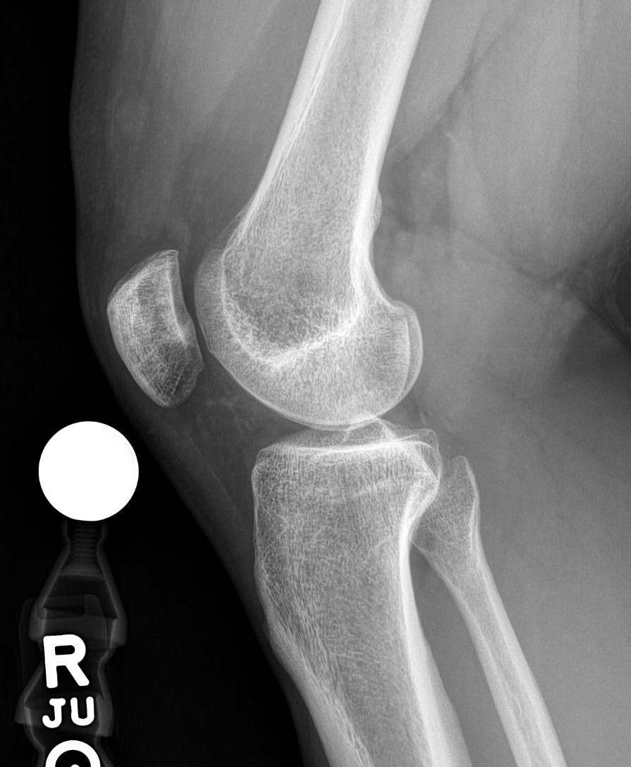 Figure 2 for case Mass