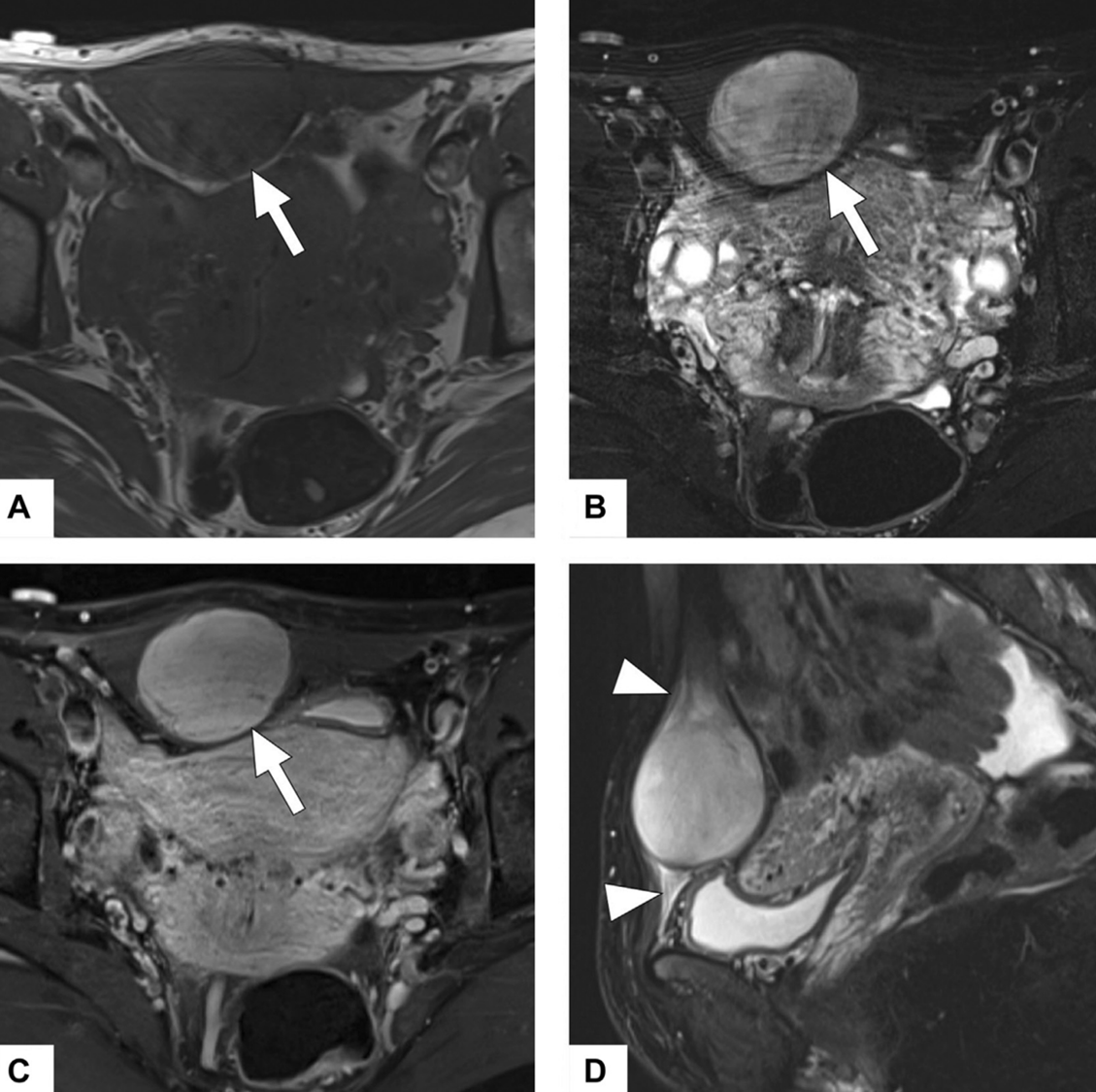 Demo case MRI